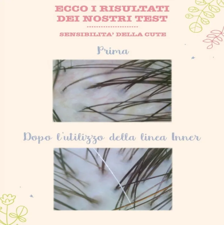 Lozione capelli lenitiva e idratante