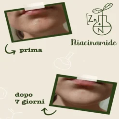 Niacinamide + Zinco